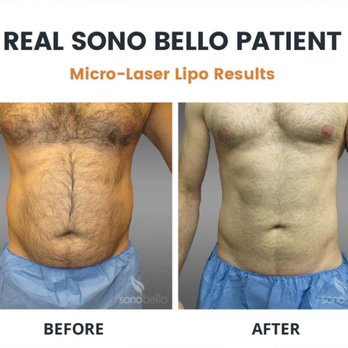 Sono Bello - Cosmetic Surgeons Near Me - Winter Park, Florida Sono Bello - Cosmetic Surgeons Near Me - Winter Park, Florida
