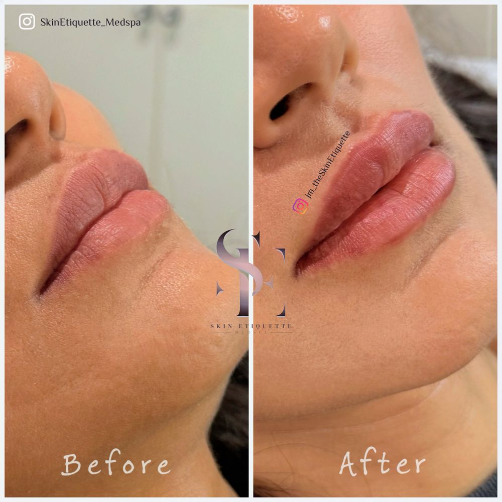 Skin Etiquette Medspa Logo