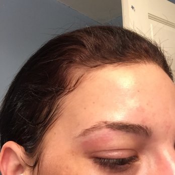 ProNails Spa - Burned from wax... - Nail Salons Near Me - Bedford, Massachusetts