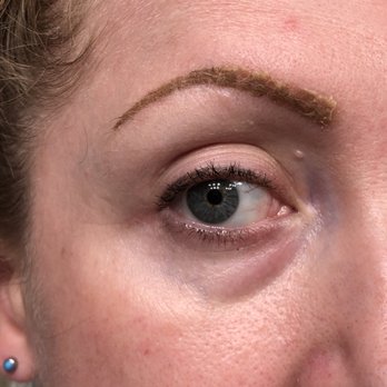 Timeless Skin Spa - 13 days after appointment. Some peeling and scabbing happened later then expected but still thrilled with the with my new eyebrows! - Permanent Makeup Near Me - Los Gatos, California Timeless Skin Spa - 13 days after appointment. Some peeling and scabbing happened later then expected but still thrilled with the with my new eyebrows! - Permanent Makeup Near Me - Los Gatos, California