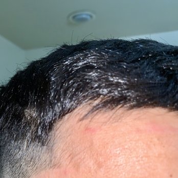 The Kingdom Barbershop - Cuts all over his forehead and the cut is just soooo uneven and sloppy - Barbers Near Me - Kent, Washington The Kingdom Barbershop - Cuts all over his forehead and the cut is just soooo uneven and sloppy - Barbers Near Me - Kent, Washington