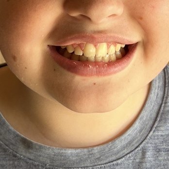 Madison Orthodontics - My sons teeth - Orthodontists Near Me - Roseville, California Madison Orthodontics - My sons teeth - Orthodontists Near Me - Roseville, California
