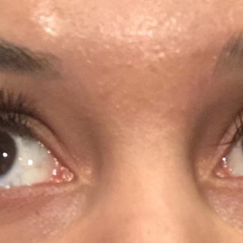 Q Beauty Lounge - Lashes four days after set was done. Notice the left eye has much less than the right - Eyelash Service Near Me - Pleasanton, California Q Beauty Lounge - Lashes four days after set was done. Notice the left eye has much less than the right - Eyelash Service Near Me - Pleasanton, California