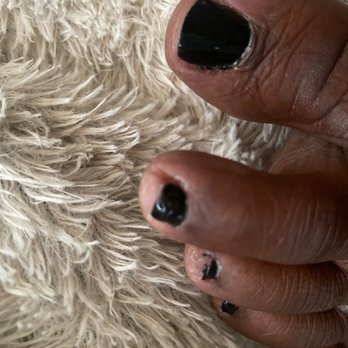 Luxecares Nails & Spa - Half of my toenail missing - Nail Salons Near Me - Clearwater, Florida Luxecares Nails & Spa - Half of my toenail missing - Nail Salons Near Me - Clearwater, Florida