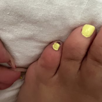 Peacock Nails - The hole in my toe that wasn't there prior to this pedicure - Nail Salons Near Me - Lemon Grove, California Peacock Nails - The hole in my toe that wasn't there prior to this pedicure - Nail Salons Near Me - Lemon Grove, California