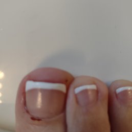 After cutting my nail. used instrument in corner.She quicky used a no bleed stick. Started to bleed again when returned home After cutting my nail. used instrument in corner.She quicky used a no bleed stick. Started to bleed again when returned home