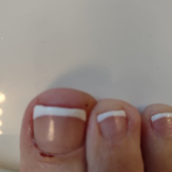 Vip Nails Too - After cutting my nail. used instrument in corner.She quicky used a no bleed stick. Started to bleed again when returned home - Nail Salons Near Me - Sussex, New Jersey Vip Nails Too - After cutting my nail. used instrument in corner.She quicky used a no bleed stick. Started to bleed again when returned home - Nail Salons Near Me - Sussex, New Jersey