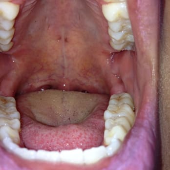 Daniel Lippiner, DDS - My clean teeth! - Periodontists Near Me - New York, New York Daniel Lippiner, DDS - My clean teeth! - Periodontists Near Me - New York, New York