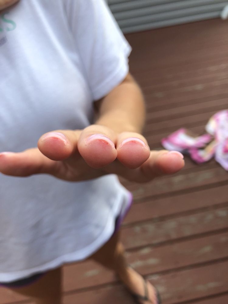 TIPS & TOES Updated September 2024 10 Photos 86 North St, Hingham