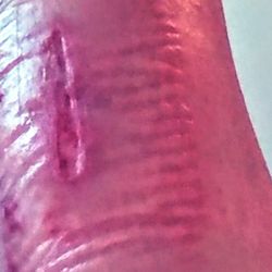 Family Care Medical Center - I was bitten by a brown recluse the doctor's staff treated me obtuse. They left me waiting in vain as I was wreathing in pain. & fired me.