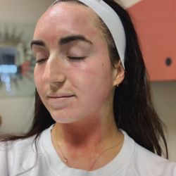 Getachew Health Center - Our micro needing procedures help with wrinkles, acne scars, fine lines, and evens skin tone.
