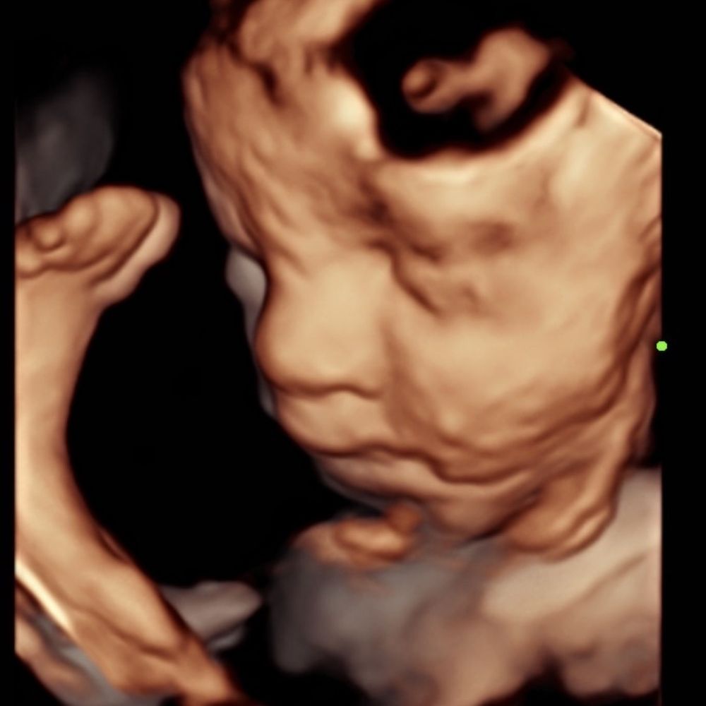 STORK VISION FRISCO Updated September 2024 43 Photos & 65 Reviews