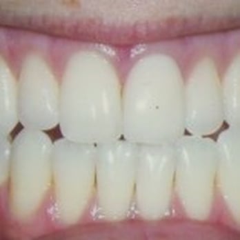S. Alicia Ramos, DDS PA - tooth veneers - General Dentistry Near Me - Durham, North Carolina S. Alicia Ramos, DDS PA - tooth veneers - General Dentistry Near Me - Durham, North Carolina