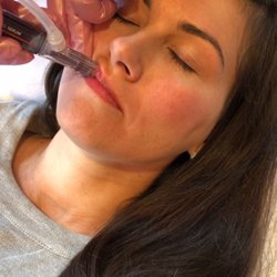 Esthetics - HydraFacial Perk Lip Treatment is a service and take-home Lip serum. Exfoliates, plumps, and hydrates.