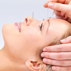 Holistic Health Care Miami - Is a 5000 years old Oriental Medical Philosophy that practices the insertion of needles at selected points of the body to sim...