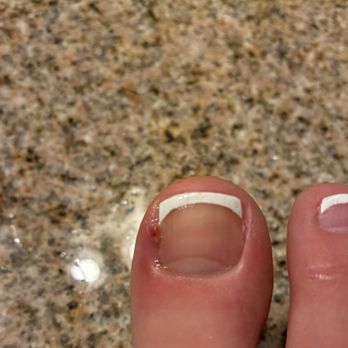 Swan Nails & Spa - This is the day after the pedicure. - Nail Salons Near Me - San Marcos, California Swan Nails & Spa - This is the day after the pedicure. - Nail Salons Near Me - San Marcos, California