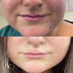 Renewing Confidence Medical Aesthetics