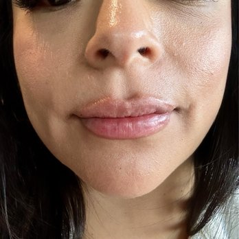 LaserAway - Medical Spas Near Me - Roseville, California