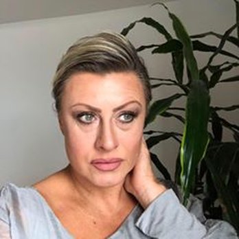 Aesthetic Center - 3 days after my botox and cheeck juvaderm fillers. Even and Proportioned.  Aft 1 ses of Carboxytherapy for under eye circles. - Medical Spas Near Me - Hinsdale, Illinois