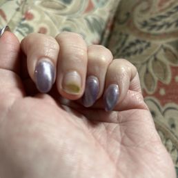green infection under my natural nail