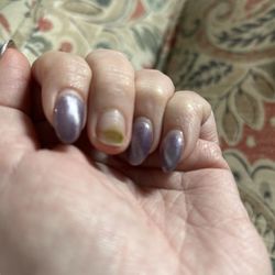 Luxe Nails - Green infection under my natural nail