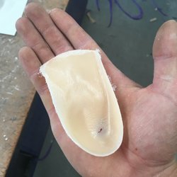 We also make orthotics for kids. Prevent the problem.