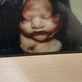 Next Generation Prenatal Imaging - Baby at 32 weeks - Ultrasound Imaging Centers Near Me - Elk Grove, California Next Generation Prenatal Imaging - Baby at 32 weeks - Ultrasound Imaging Centers Near Me - Elk Grove, California