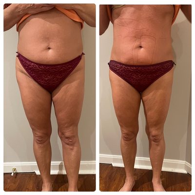 Body By Design Aesthetics Studio