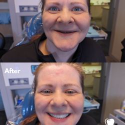Finn Hill Dental
