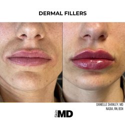 SkinMD