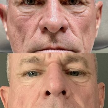 A Prestige Aesthetics and Wellness - Agejet laser - Medical Spas Near Me - Franklin, Tennessee A Prestige Aesthetics and Wellness - Agejet laser - Medical Spas Near Me - Franklin, Tennessee