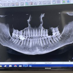 Armitage Oral Surgery - X-Ray