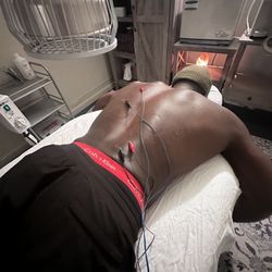 Likha Acupuncture and Wellness - Electroacupuncture and cupping for low back and mid-thoracic injury