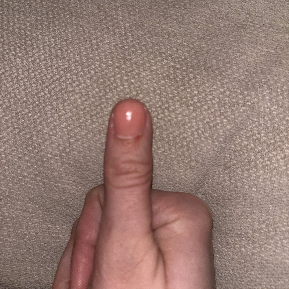 Sally's Spa - Cuticle cut :( - Nail Salons Near Me - Burlingame, California Sally's Spa - Cuticle cut :( - Nail Salons Near Me - Burlingame, California
