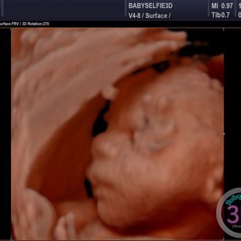 Baby Selfie 3D - Ultrasound Imaging Centers Near Me - Pembroke Pines, Florida Baby Selfie 3D - Ultrasound Imaging Centers Near Me - Pembroke Pines, Florida