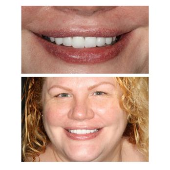 Prestige Dentistry - Trinity - General Dentistry Near Me - Trinity, Florida Prestige Dentistry - Trinity - General Dentistry Near Me - Trinity, Florida