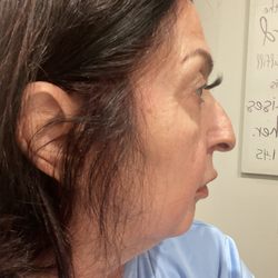 Atalla Plastic Surgery Skin + Laser - Profile