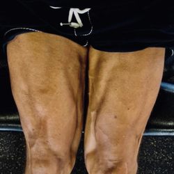 Rothman Orthopaedics