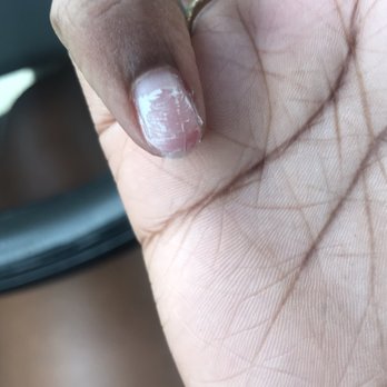 Crystal Nails & Spa - Ripped off half my nail - Nail Salons Near Me - Miami Gardens, Florida