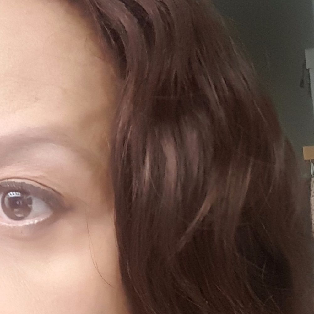 Valley Plastic Surgery Center - Bubble underneath my eye - bad surgery Dr. Lambruschi. - Plastic Surgeons Near Me - West Dundee, Illinois Valley Plastic Surgery Center - Bubble underneath my eye - bad surgery Dr. Lambruschi. - Plastic Surgeons Near Me - West Dundee, Illinois
