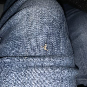 Mahr Elder, DDS MD - Completely intact obvious stitches... that literally just fell out of my mouth.. - Oral Surgeons Near Me - Novato, California Mahr Elder, DDS MD - Completely intact obvious stitches... that literally just fell out of my mouth.. - Oral Surgeons Near Me - Novato, California