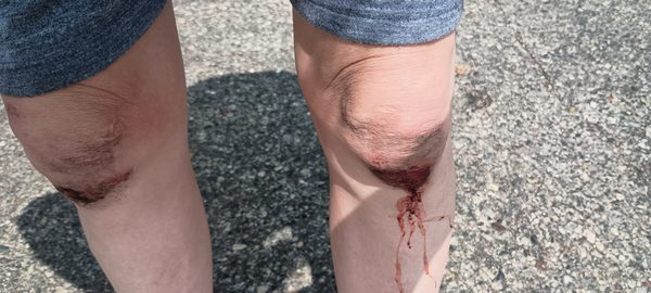 Abbott Northwestern Hospital by null