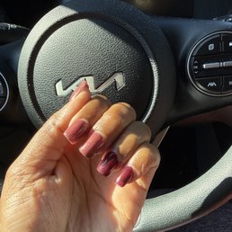 My fucked up nails.