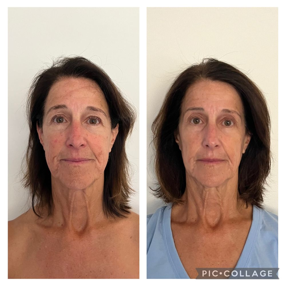 Laura Vera Skin Care Logo