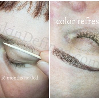 skinDefined - Microblading - Medical Spas Near Me - Phoenix, Arizona skinDefined - Microblading - Medical Spas Near Me - Phoenix, Arizona
