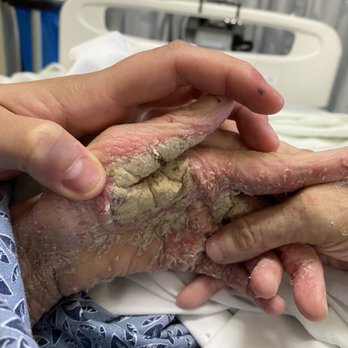 Las Colinas Post Acute - Skilled Nursing Near Me - Ontario, California Las Colinas Post Acute - Skilled Nursing Near Me - Ontario, California