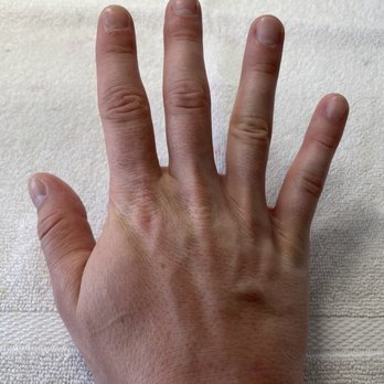 Topline Nails - My finger nails before the manicure. - Nail Salons Near Me - Lawndale, California