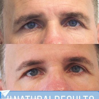 Carniol Plastic Surgery - In-office treatment for men and women - Plastic Surgeons Near Me - Summit, New Jersey