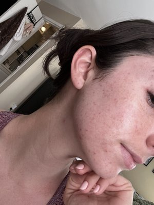 Acne Institute by null