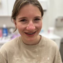 Facet Piercing & Fine Jewelry - My daughter immediately after the piercing.